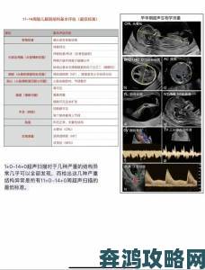 深度调查ALPHA孕囊顶开在分娩中的应用现状与未来